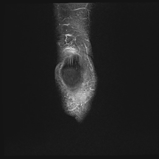 Click on the Serie image to view the images of Wieszt, Gnter